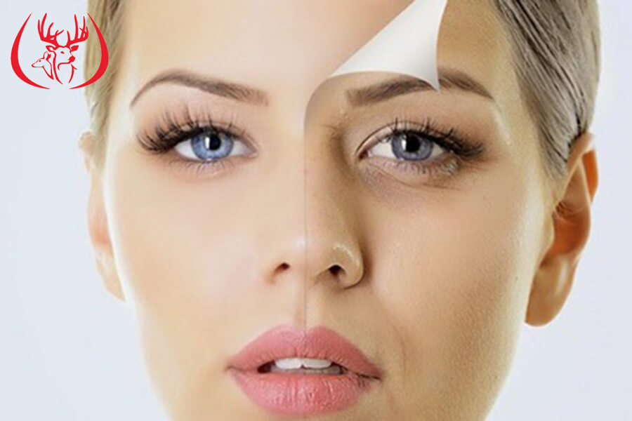 Chống lão hóa da, giữ gìn tuổi xuân