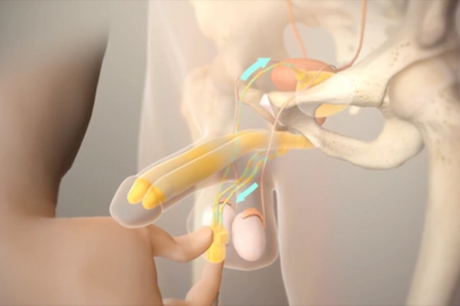 Nguyên nhân gây chứng liệt dương