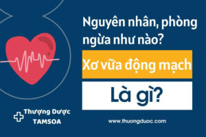 Xơ Vữa Động Mạch Là Gì? Nguyên Nhân, Biểu Hiện, Đối Tượng