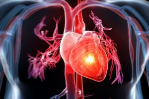 Bệnh tim mạch là gì? Dấu hiệu và những căn bệnh thường gặp