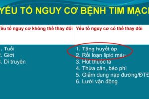 Các yếu tố nguy cơ tim mạch là gì? Cách phòng tránh bệnh