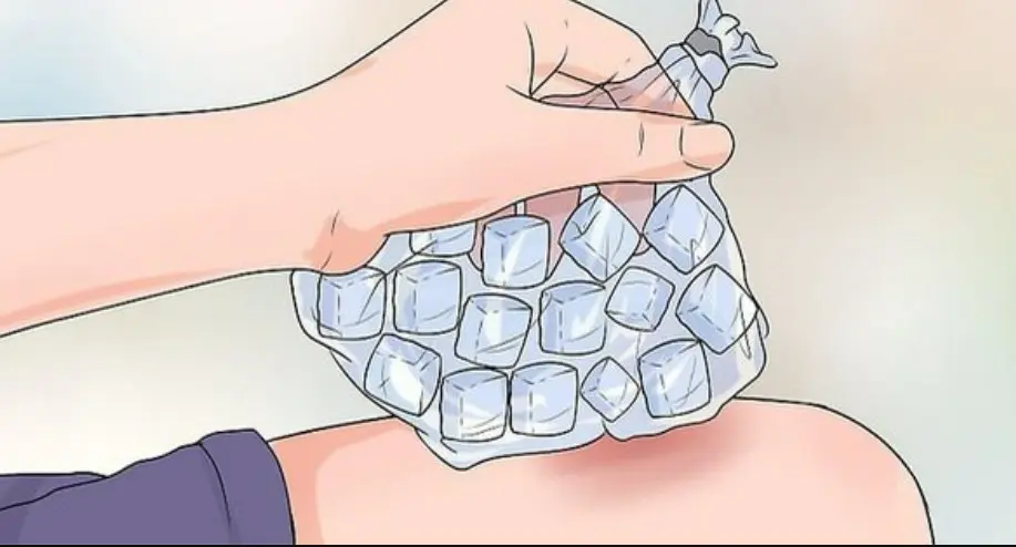 Phương pháp chườm lạnh