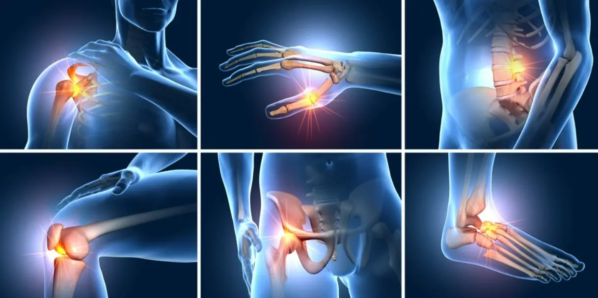 Tổng quan bệnh cơ xương khớp