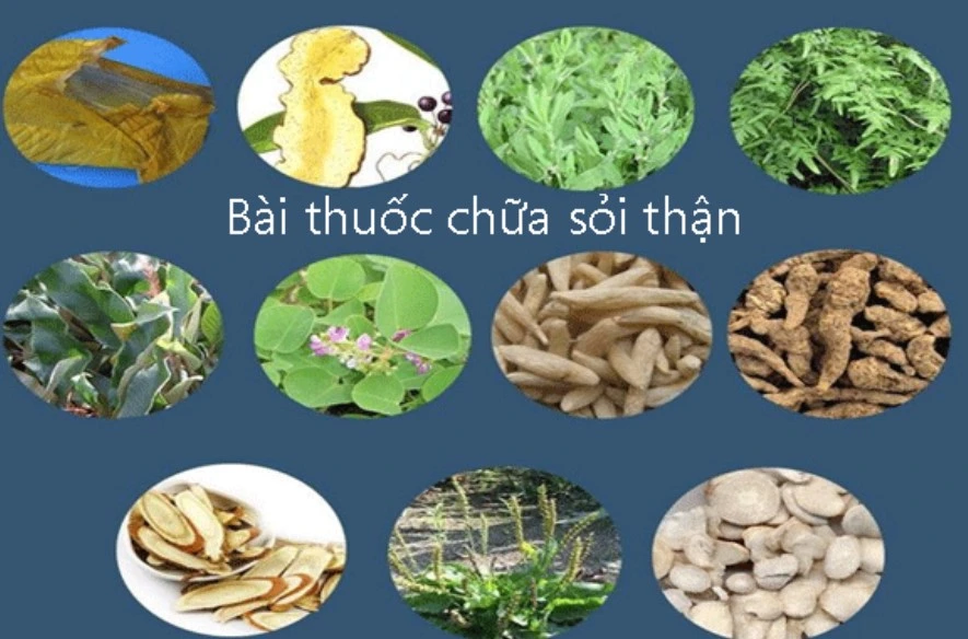 những cây thuốc nam trị sỏi thận