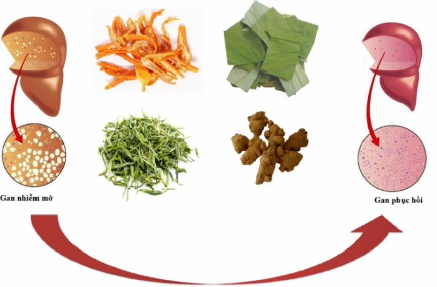 Điều trị gan nhiễm mỡ bằng thuốc nam