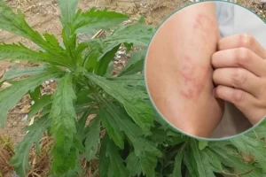 TOP 15 Cây thuốc trị ngứa ngoài da hiệu quả và dễ tìm nhất