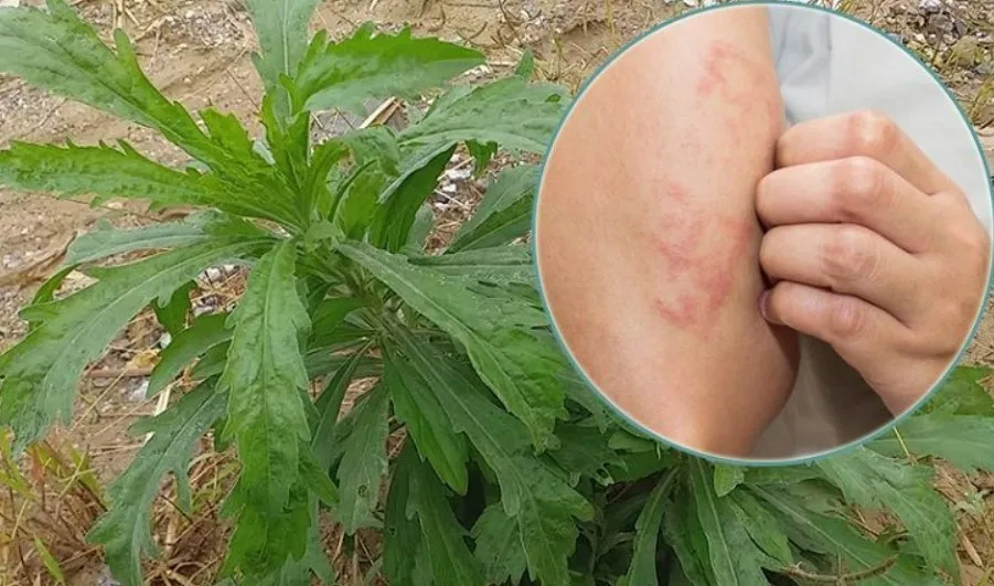 Cây ngải dại - Cây thuốc trị ngứa ngoài da