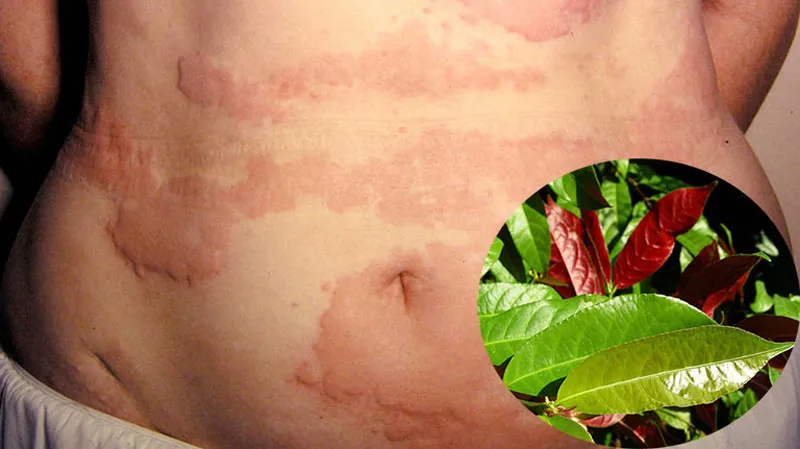 Lá đơn đỏ - Cây thuốc trị ngứa ngoài da