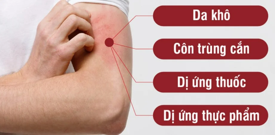 Nguyên nhân khiến da bị ngứa