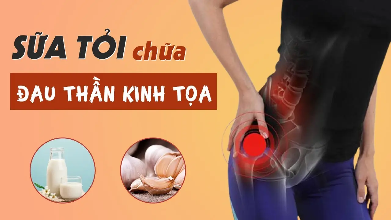 Sữa tỏi giúp chữa đau dây thần kinh tọa