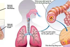 Những cây thuốc trị ho từ dân gian hiệu quả tốt nhất