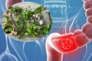 TOP 12+ Cây thuốc nam chữa bệnh viêm đại tràng hiệu quả