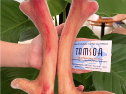 Người bị gout có dùng được nhung hươu không?
